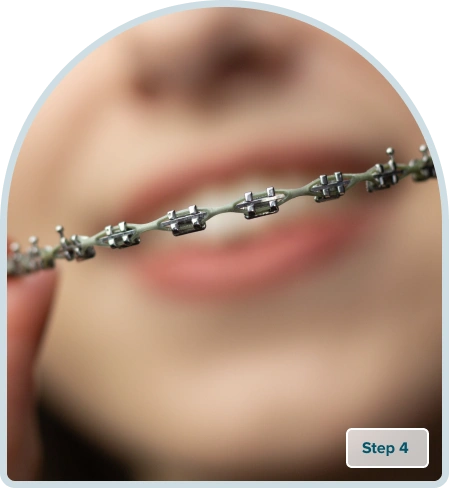 Braces in Turkey