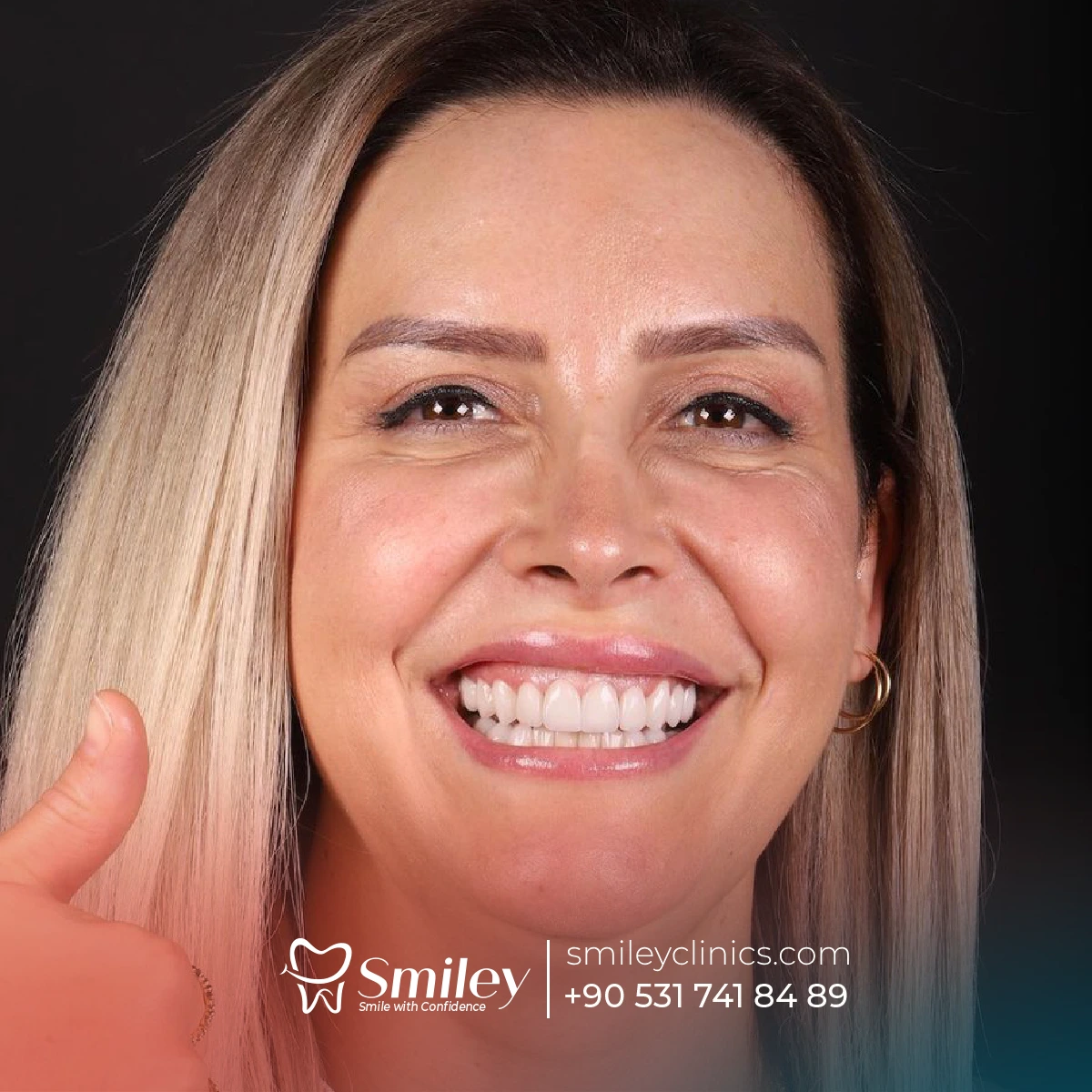 dental implants turkey